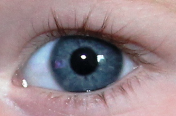 Eye